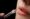 lip fillers in islamabad