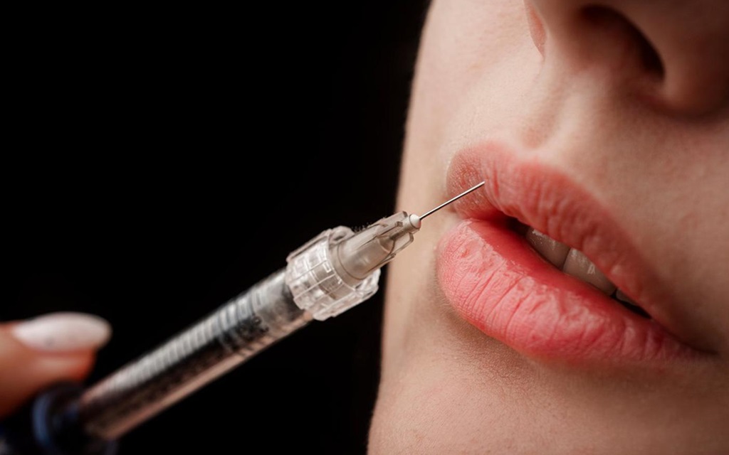 lip fillers in islamabad