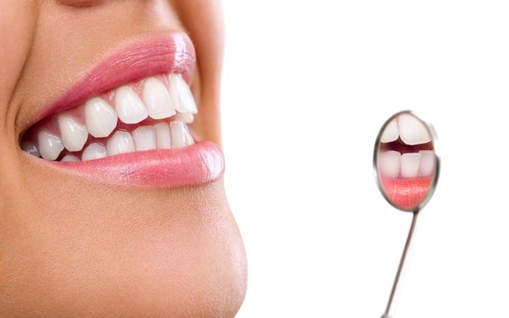 teeth whitening in Islamabad