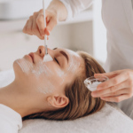 Best Chemical Peels for Sensitive Skin