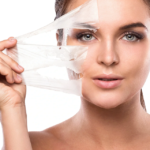 Can Chemical Peels Help with Sun Damage