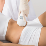 Is Laser Hair Removal Permanent or Temporary