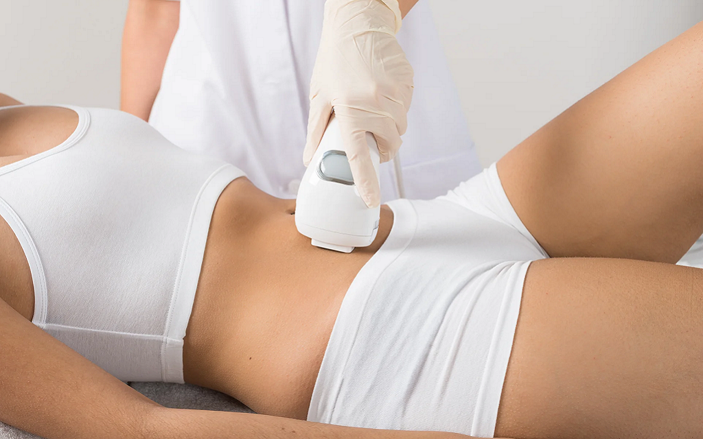 Is Laser Hair Removal Permanent or Temporary