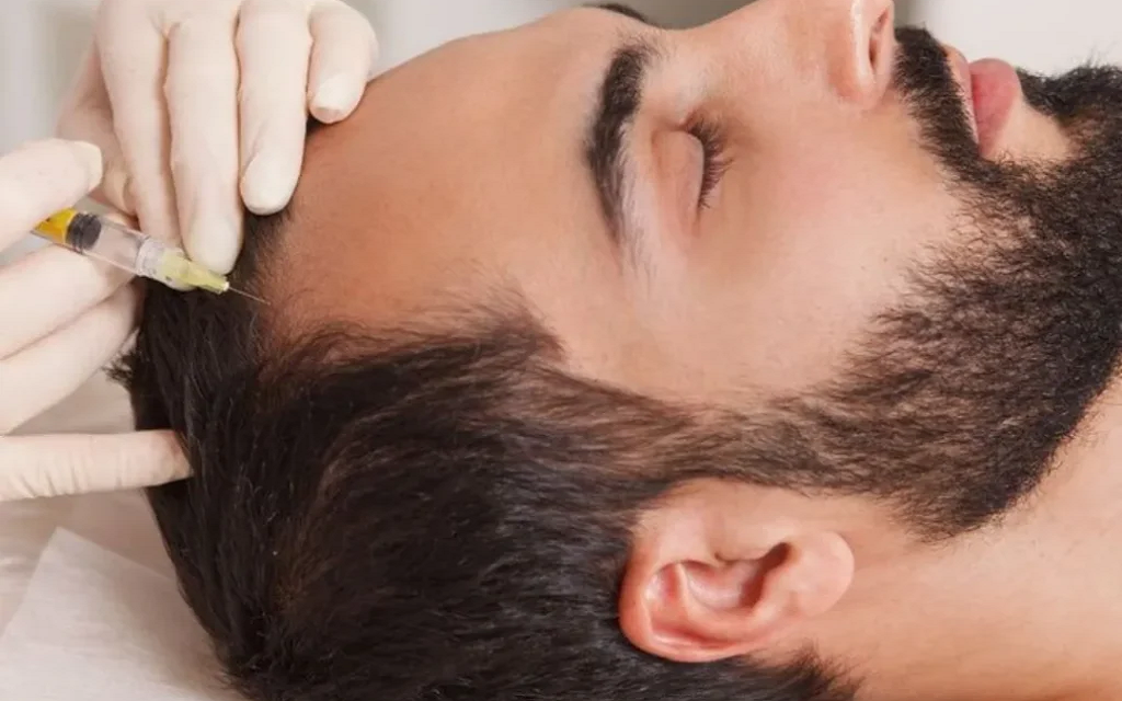 Reasonable PRP Treatment for Men in Islamabad