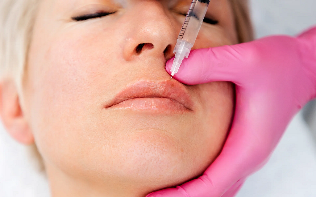 How Lip Fillers Can Boost Your Confidence