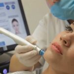 10 Benefits of Hydrafacial