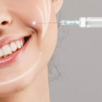 Laugh Line Fillers Cost in Islamabad