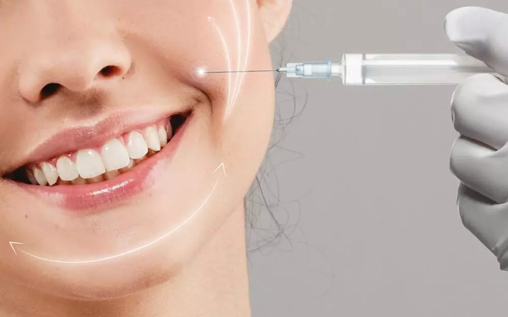 Laugh Line Fillers Cost in Islamabad