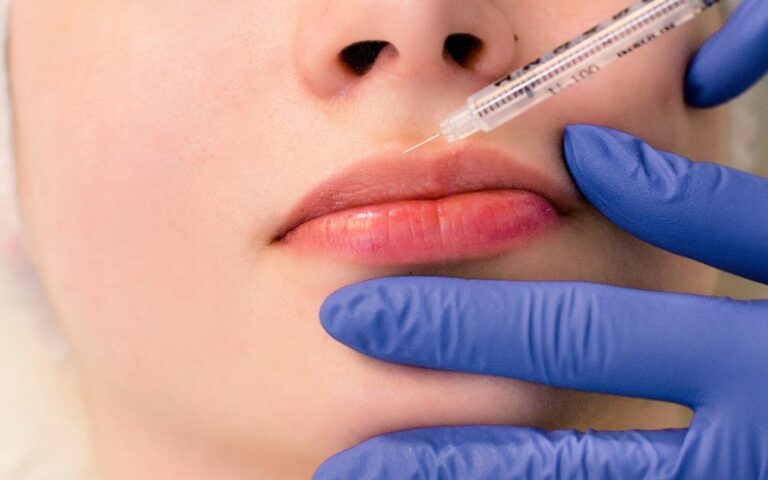 Lip Fillers Cost in Islamabad