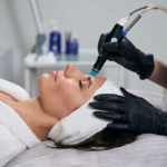Can You Get a Hydrafacial After Laser Hair Removal