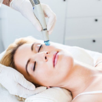 Does HydraFacial Whiten Skin