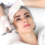 Can Hydrafacial Help with Skin Discoloration
