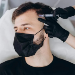 How Hair Transplants Restore Natural Hair Growth