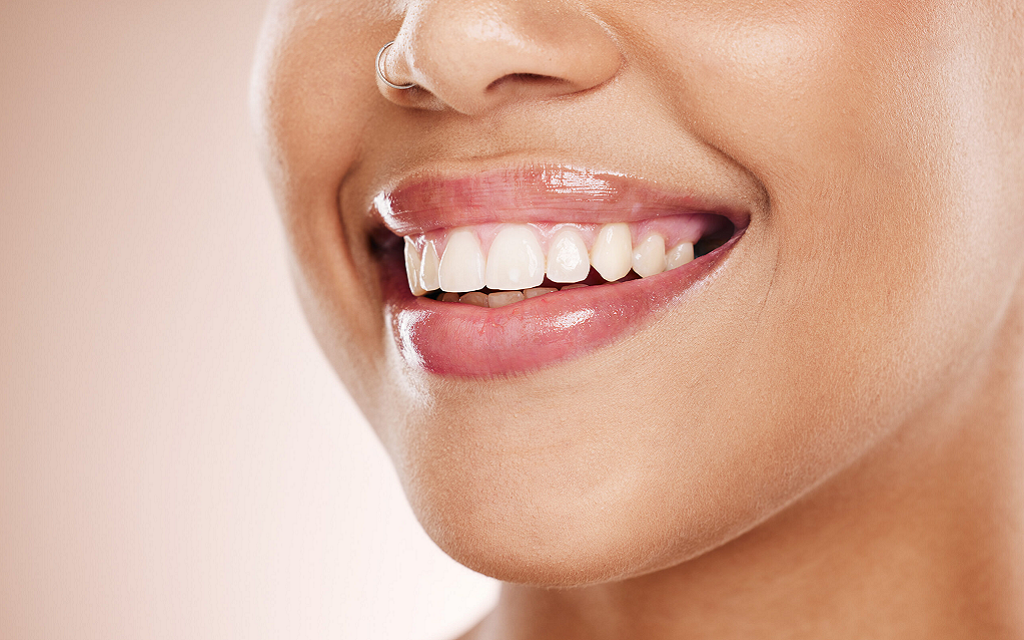 How Often Should You Whiten Your Teeth?