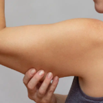 How to Maintain Results After an Arm Lift