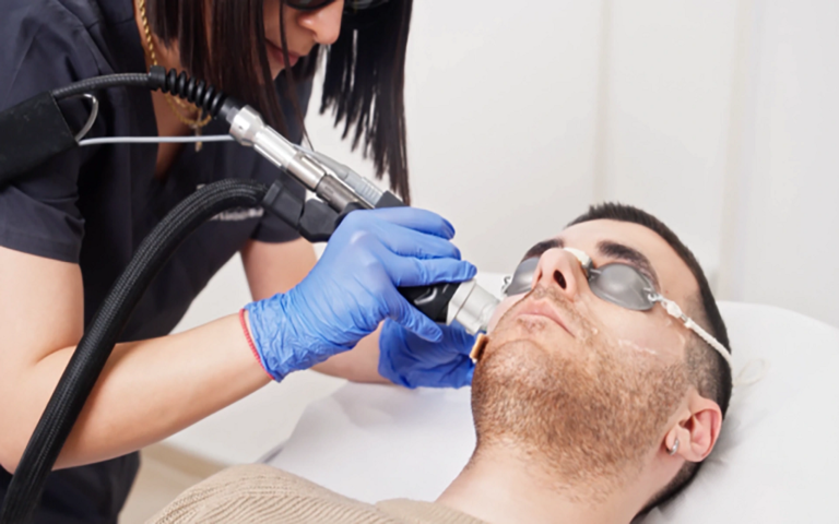 How Laser Hair Removal Works for Smooth Skin