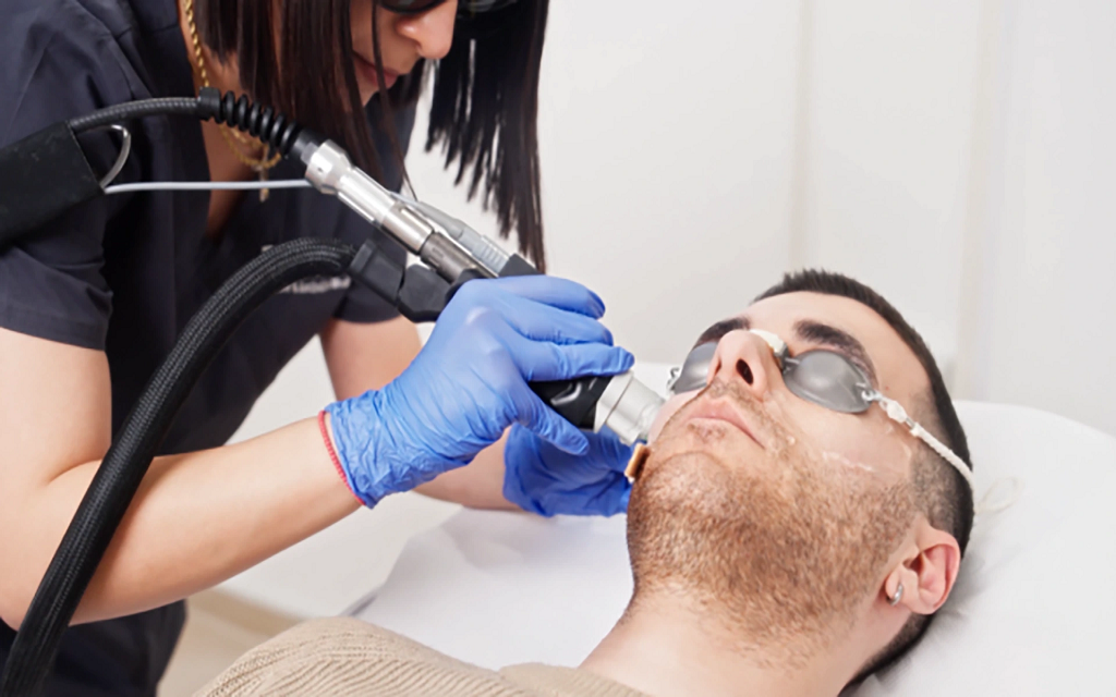 How Laser Hair Removal Works for Smooth Skin