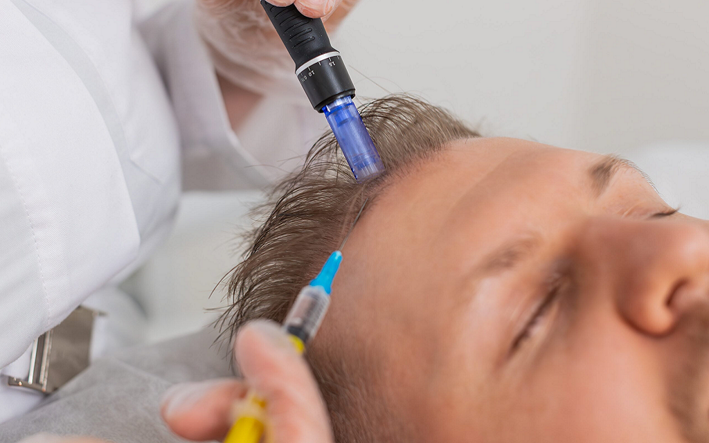 Exosome Therapy for Skin & Hair Regeneration