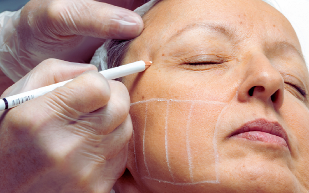 How HIFU Helps in Anti-Aging and Skin Lifting?