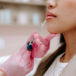 Long-Lasting Lip Filler Tips for a Perfect Pout