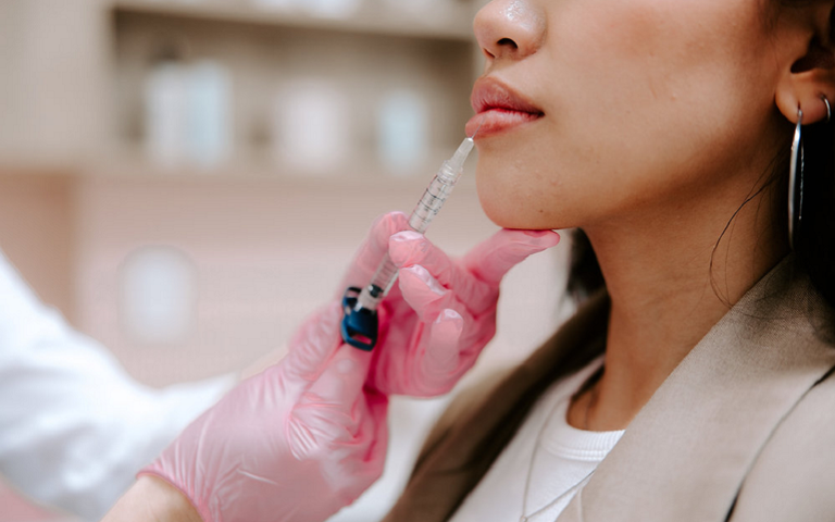 Long-Lasting Lip Filler Tips for a Perfect Pout