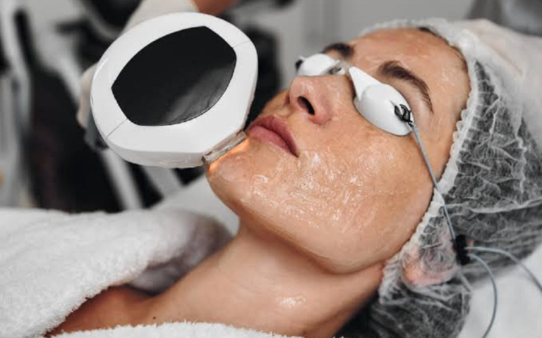How Is Sculptra Different From Other Facial Fillers