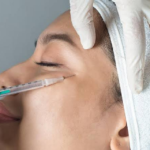 Smooth Out Your Wrinkles With Dermal Fillers