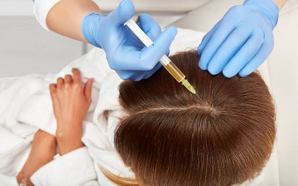 Benefits of PRP for Hair Restoration