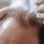 Hair Regrowth & Skin Renewal with Exosomes