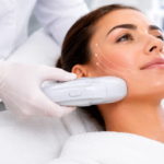 Lift and Tighten Skin with HIFU Therapy What You Need to Know