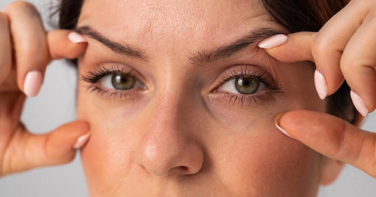 Say Goodbye to Droopy Eyelids with Surgery