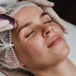 Hyperpigmentation Treatment for Black Skin in Islamabad