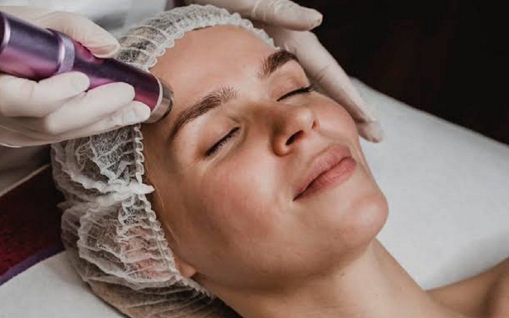Hyperpigmentation Treatment for Black Skin in Islamabad