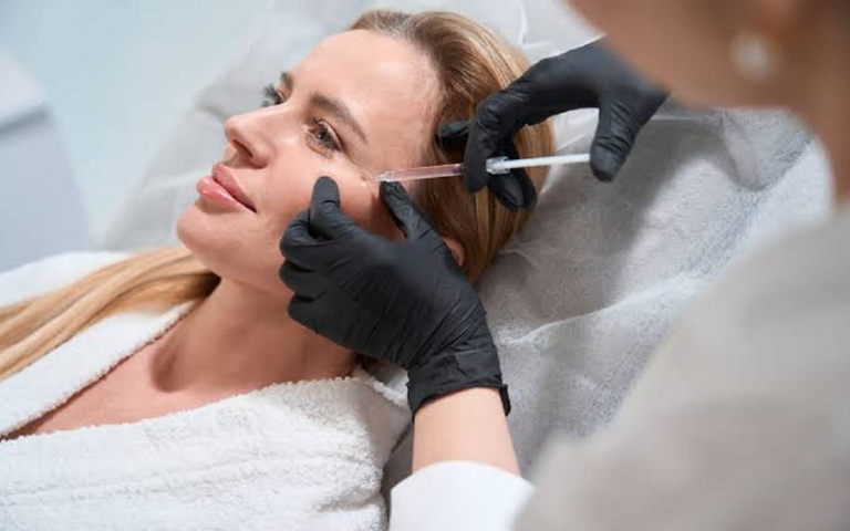 Instant Lift How Fillers Create a Youthful V Shape