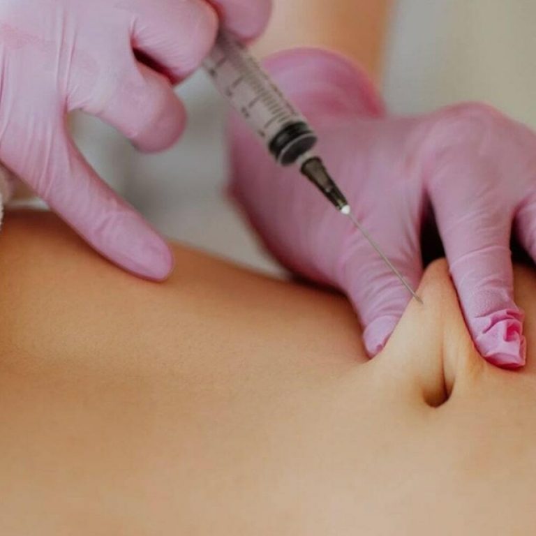 Belly Fat Removal Without Surgery in Pakistan