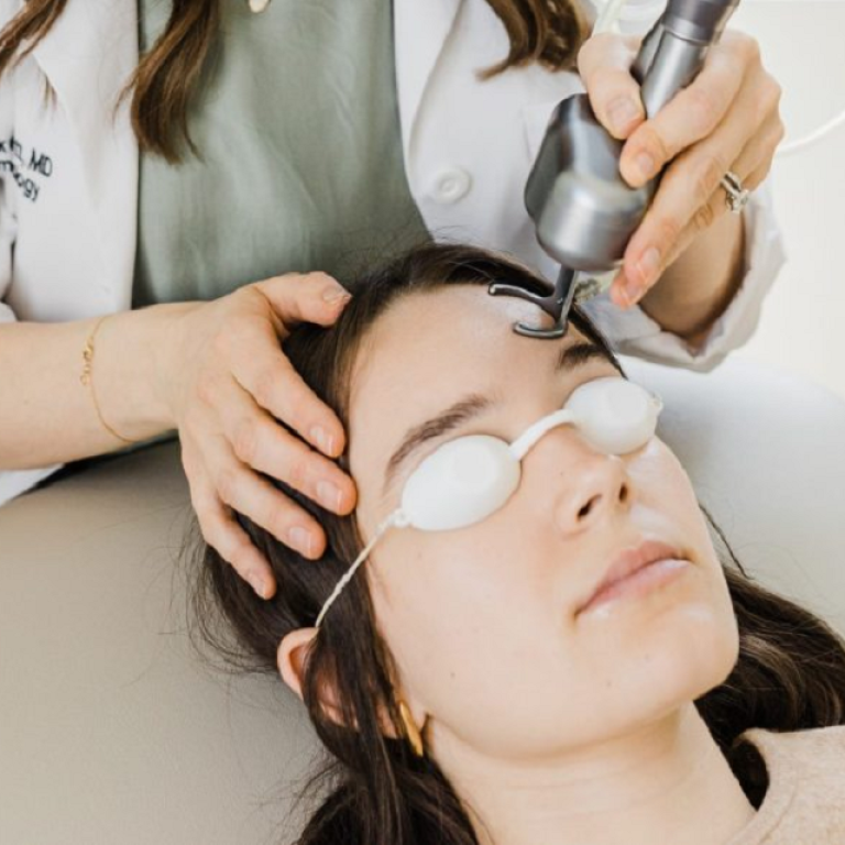 Best Doctor for Acne Scars Treatment in Islamabad