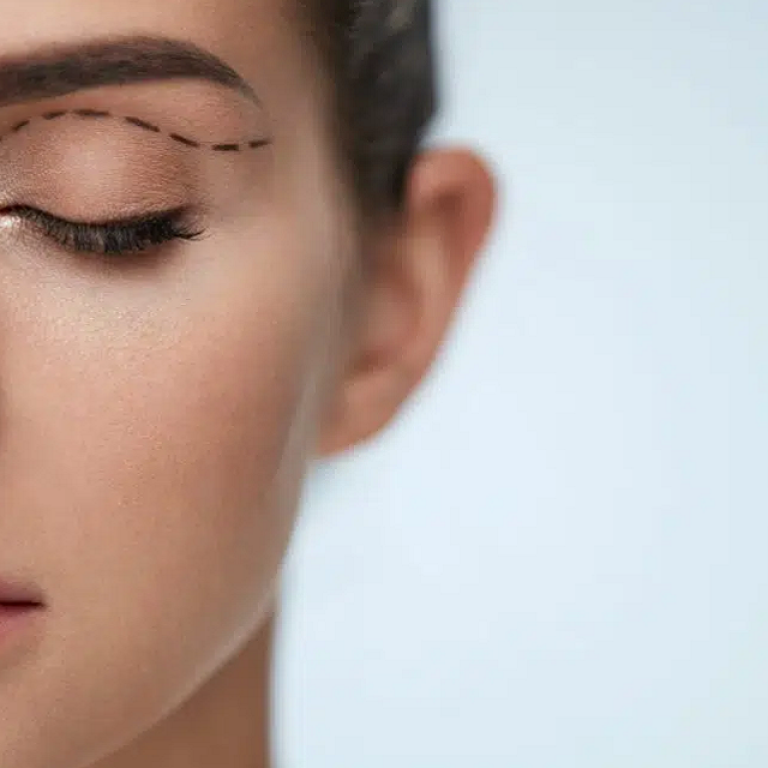 Eyelid Surgery for Droopy or Puffy Eyes in Islamabad