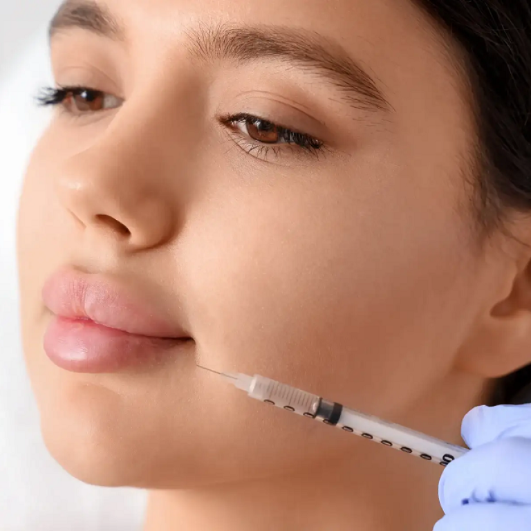 Fuller Lips in Minutes Your Complete Lip Filler Guide