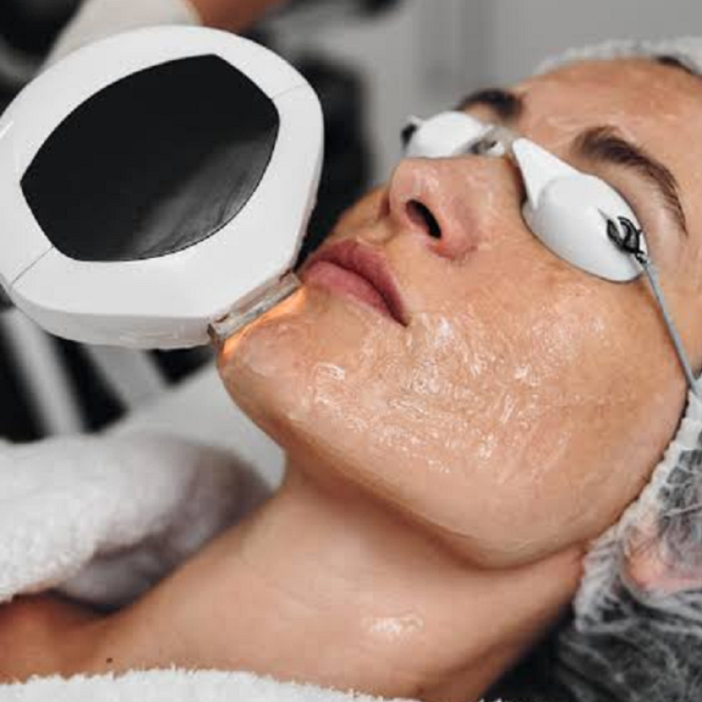 How Is Sculptra Different From Other Facial Fillers