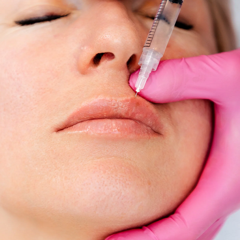 How Lip Fillers Can Boost Your Confidence