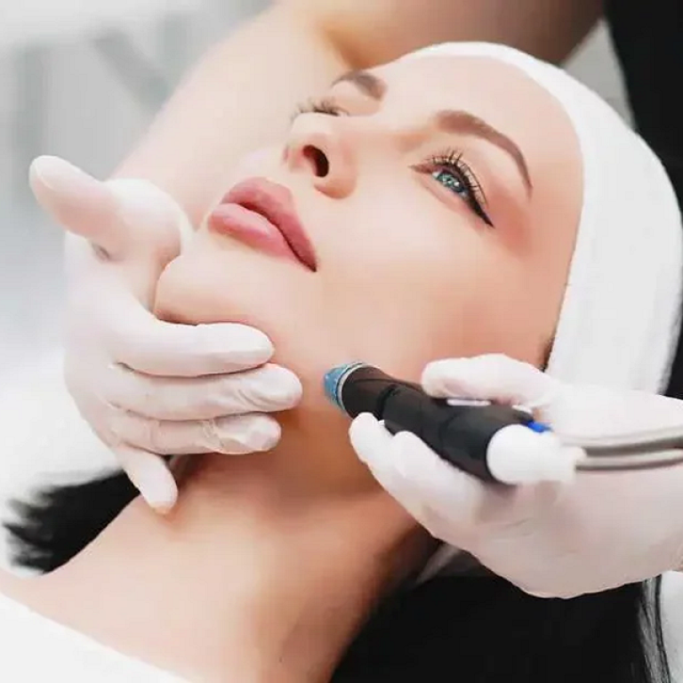 HydraFacial Treatment Cost in Islamabad