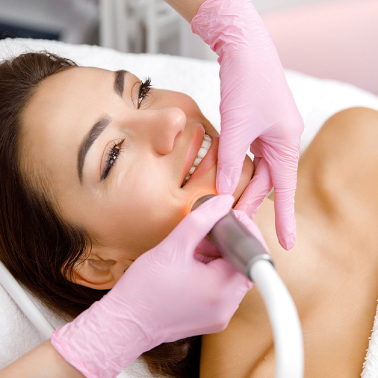 Laser Whitening vs. Peels What’s More Effective