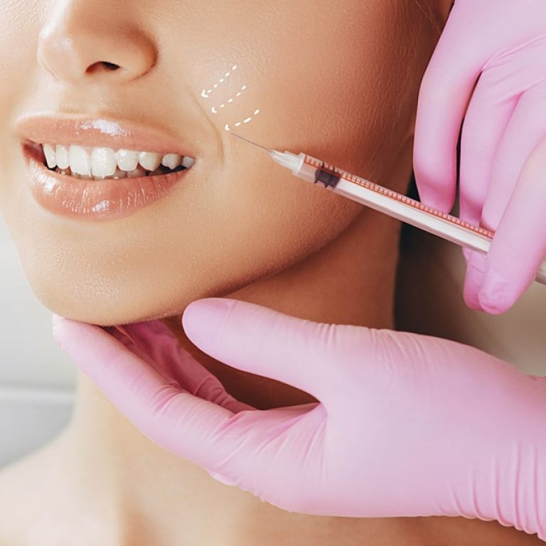 Laugh Line Filler in Islamabad