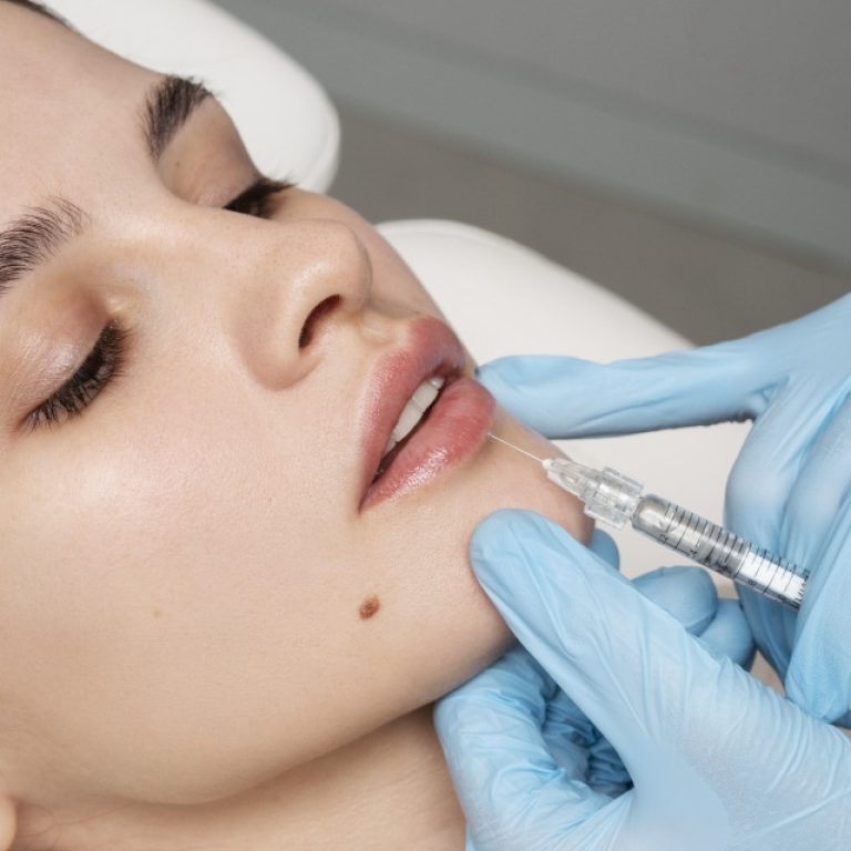 Lip Augmentation in Islamabad