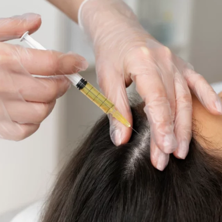 PRP Treatment for Hair Loss Islamabad