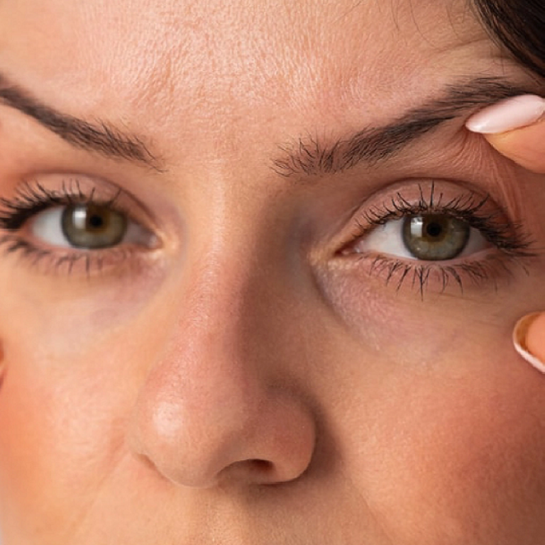Say Goodbye to Droopy Eyelids with Surgery