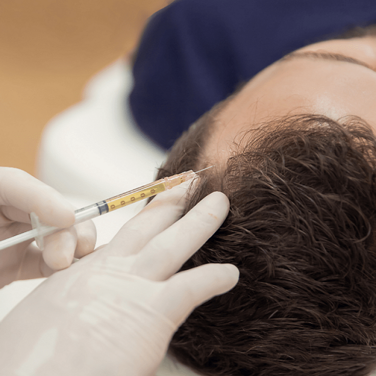 Why PRP Has Become So Popular in Islamabad