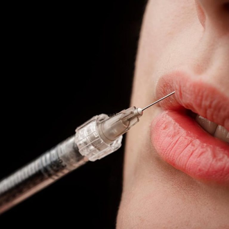 lip fillers in islamabad