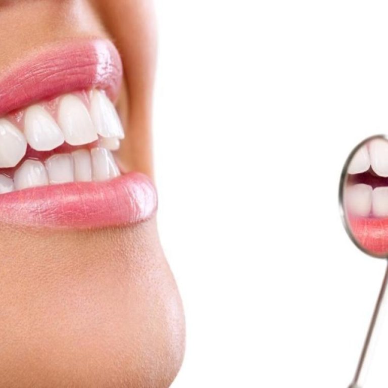 teeth whitening in Islamabad