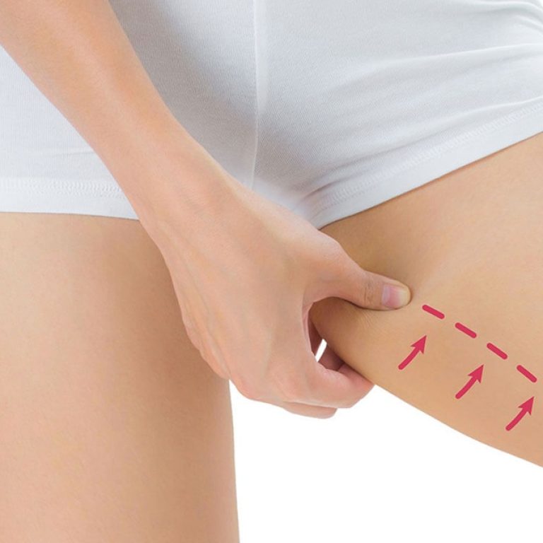 thigh liposuction in Islamabad